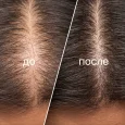 Applying Hair Booster leave-in serum to the scalp along the partings